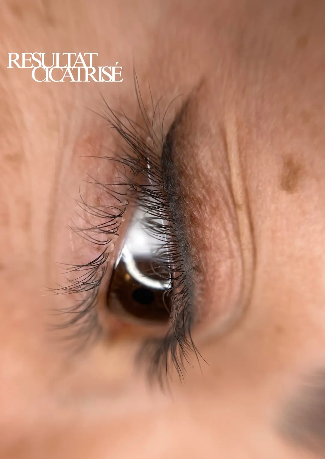 Soins cils / yeux — Browlift