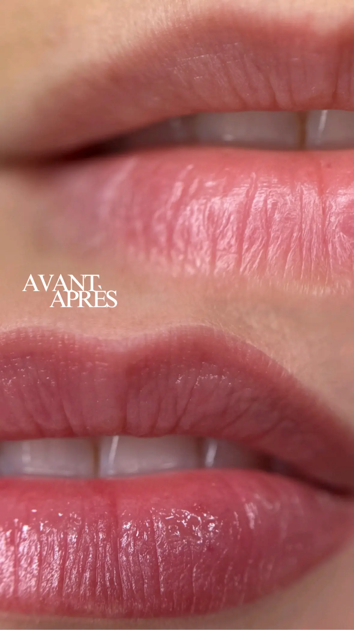Lèvres — Candy Lips