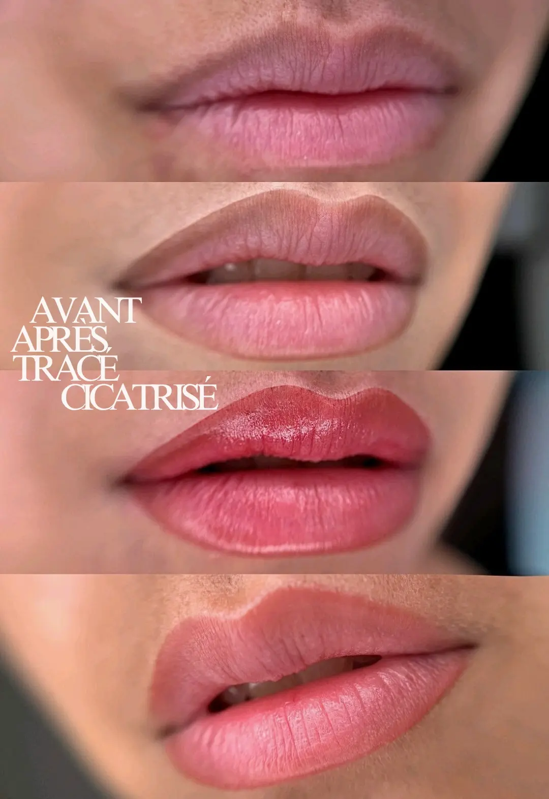 Lèvres — Candy Lips