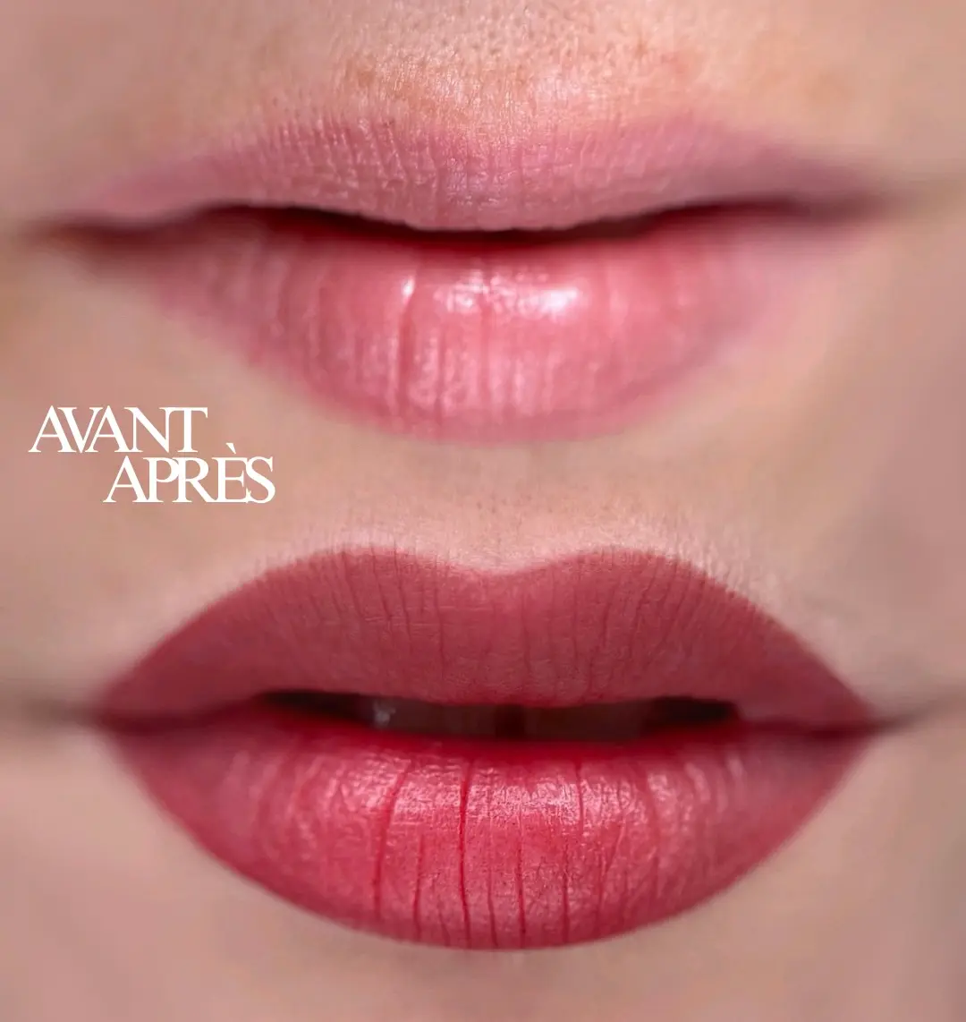 Lèvres — résultat naturel