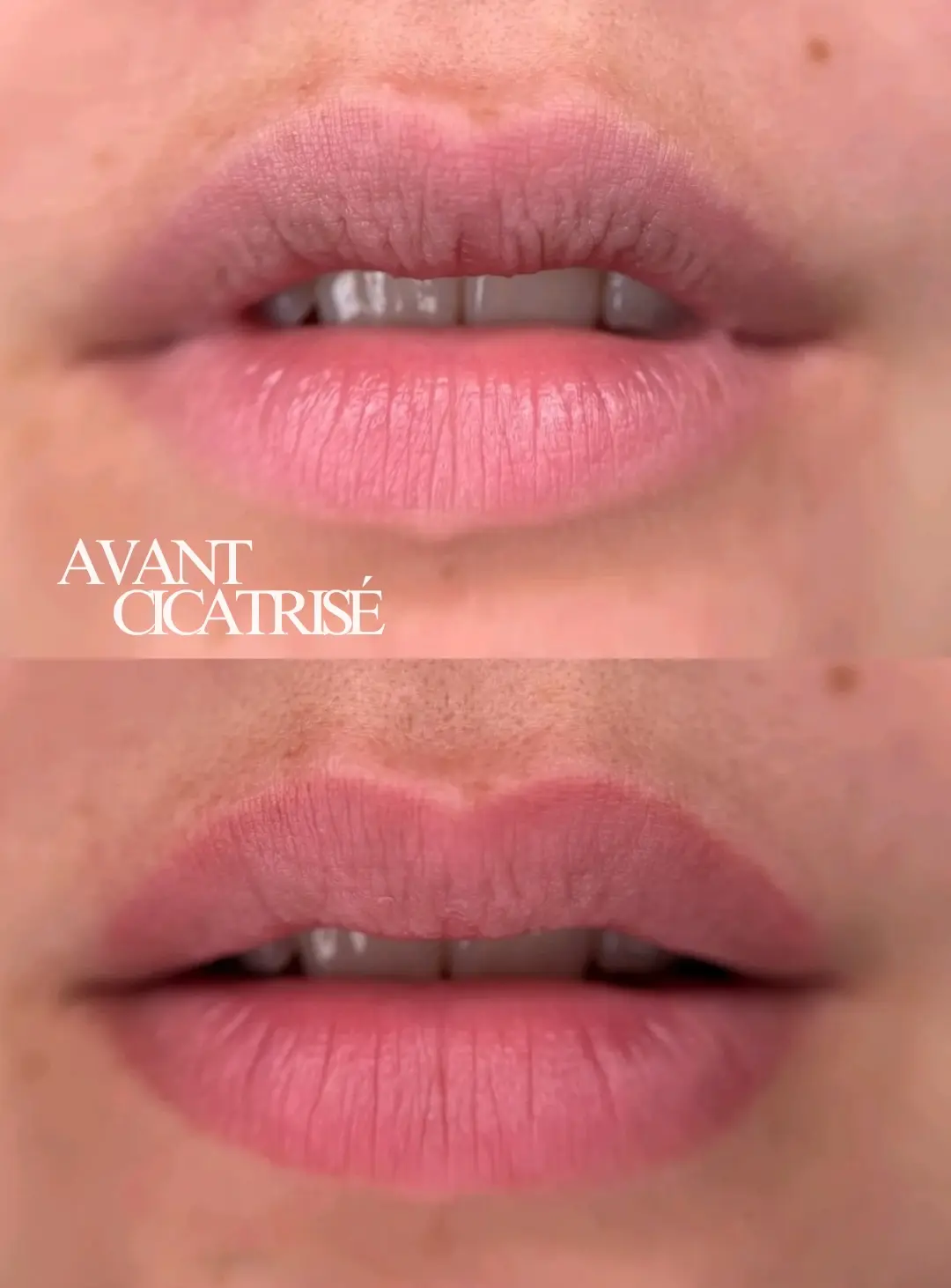 Lèvres — définition et couleur