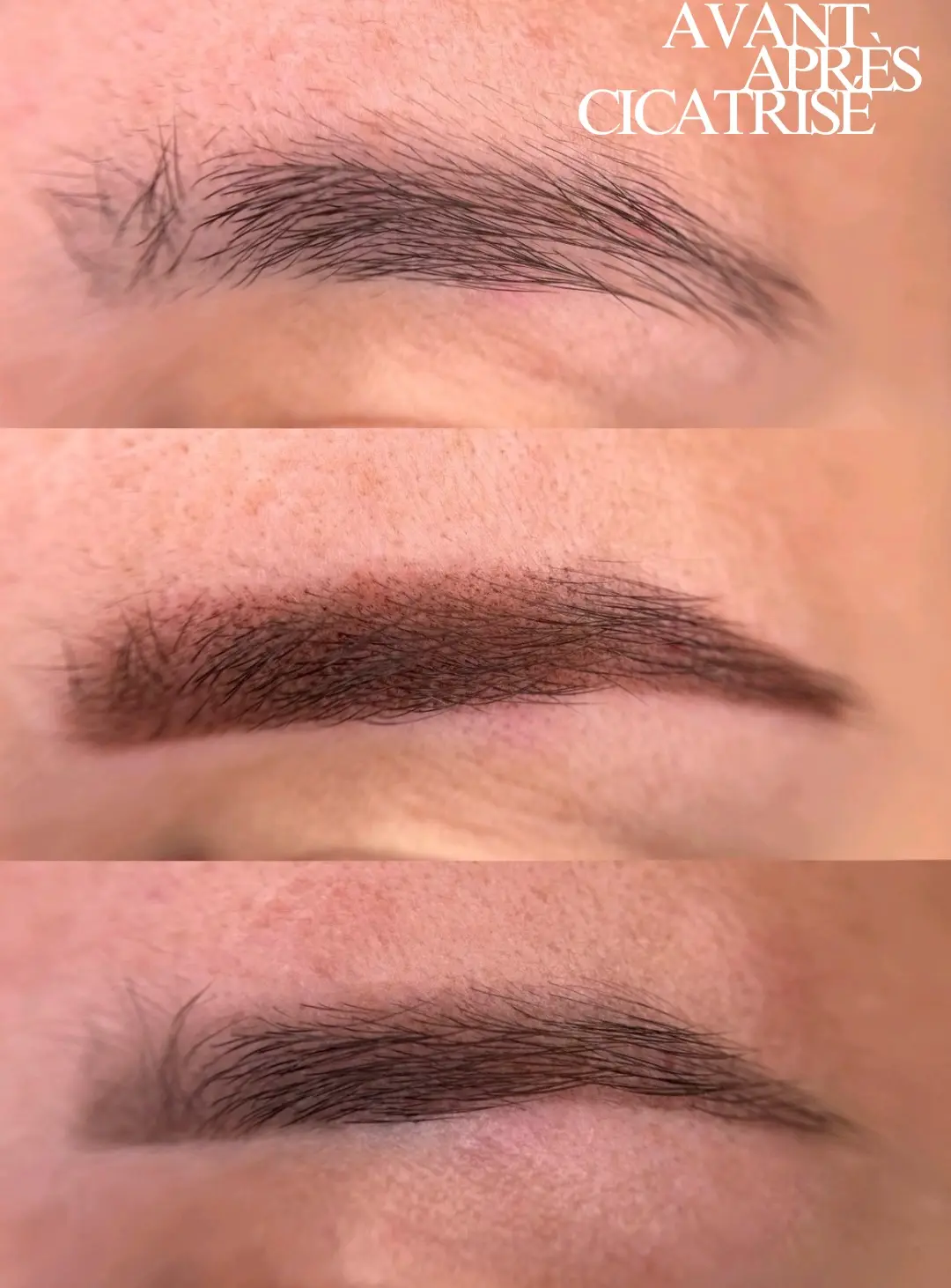 Sourcils — résultat naturel